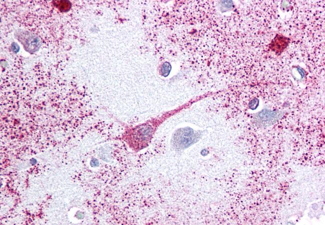 PTGER3 Antibody in Immunohistochemistry (Paraffin) (IHC (P))