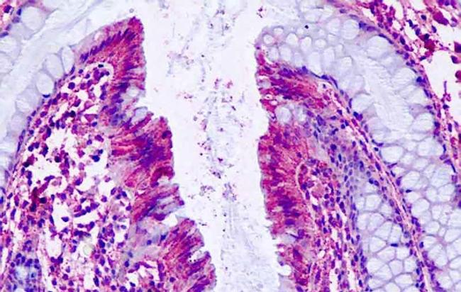 PTGER4 Antibody in Immunohistochemistry (Paraffin) (IHC (P))