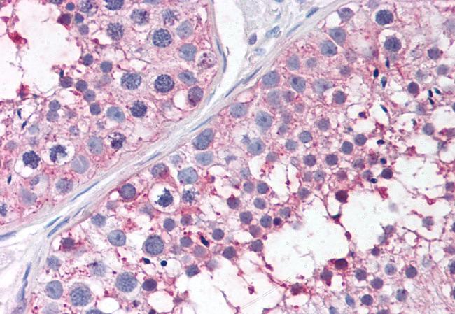 PTGES Antibody in Immunohistochemistry (Paraffin) (IHC (P))