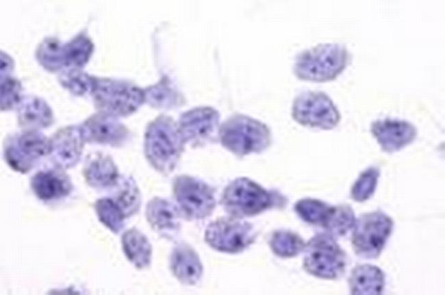 PTGFR Antibody in Immunocytochemistry (ICC/IF)