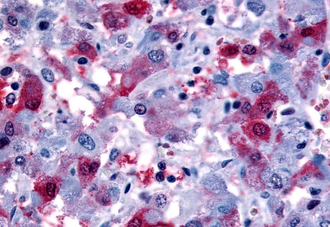 PTGFR Antibody in Immunohistochemistry (Paraffin) (IHC (P))