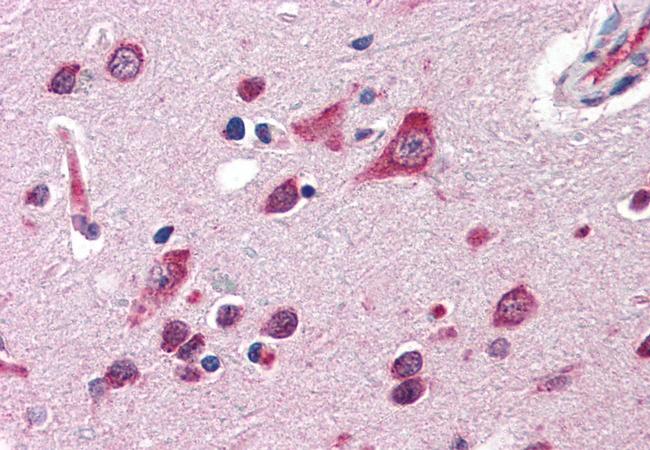 QSOX2 Antibody in Immunohistochemistry (Paraffin) (IHC (P))