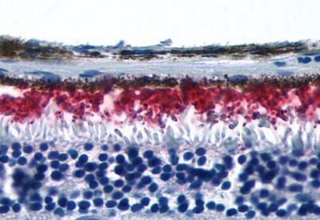 Rhodopsin Antibody in Immunohistochemistry (Paraffin) (IHC (P))