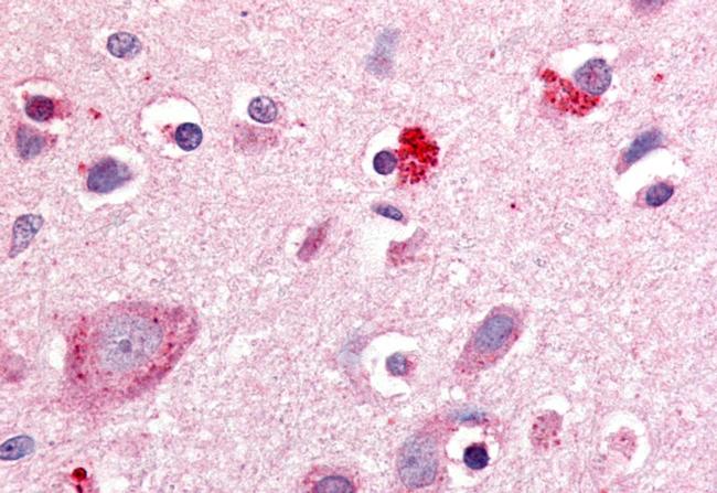 RORB Antibody in Immunohistochemistry (Paraffin) (IHC (P))