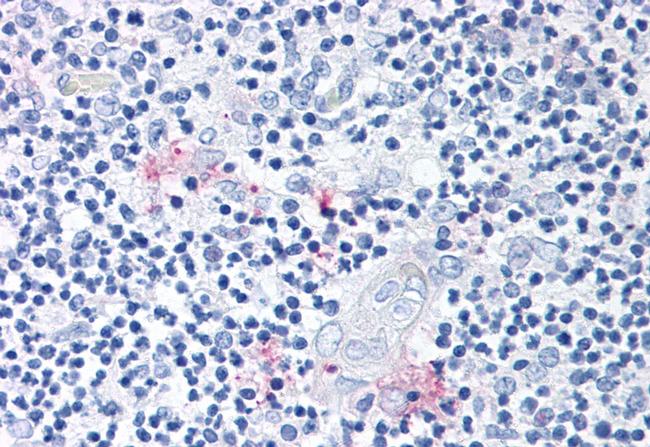 ROR gamma Antibody in Immunohistochemistry (Paraffin) (IHC (P))