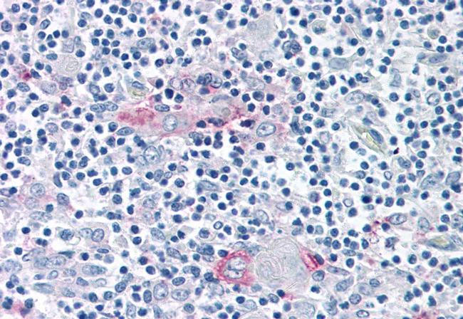 ROR gamma Antibody in Immunohistochemistry (Paraffin) (IHC (P))