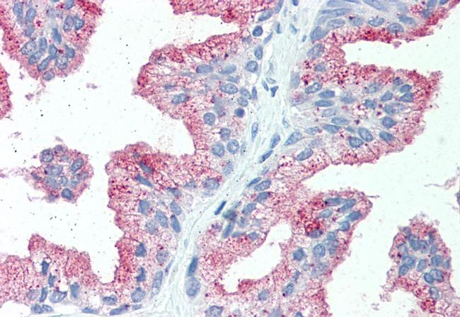 ZIP14 Antibody in Immunohistochemistry (Paraffin) (IHC (P))