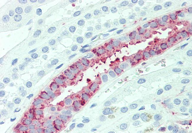 SLC4A2 Antibody in Immunohistochemistry (Paraffin) (IHC (P))