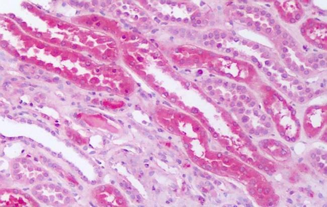 SMO Antibody in Immunohistochemistry (Paraffin) (IHC (P))