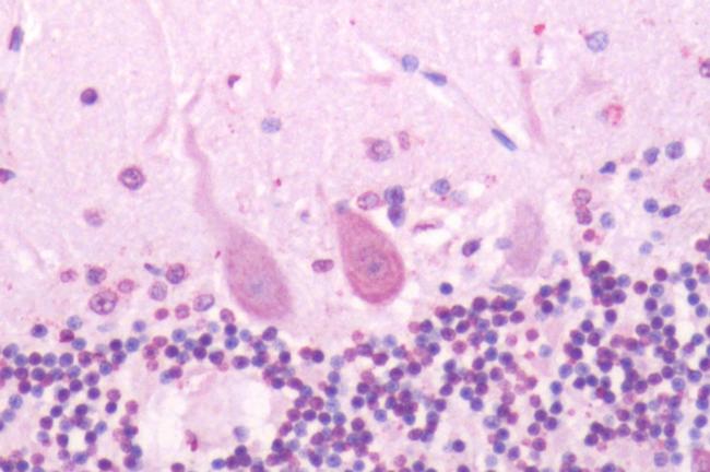 SSTR2 Antibody in Immunohistochemistry (Paraffin) (IHC (P))