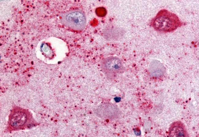 SSTR2 Antibody in Immunohistochemistry (Paraffin) (IHC (P))