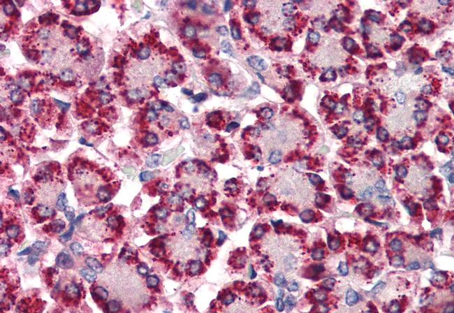 STEAP4 Antibody in Immunohistochemistry (Paraffin) (IHC (P))