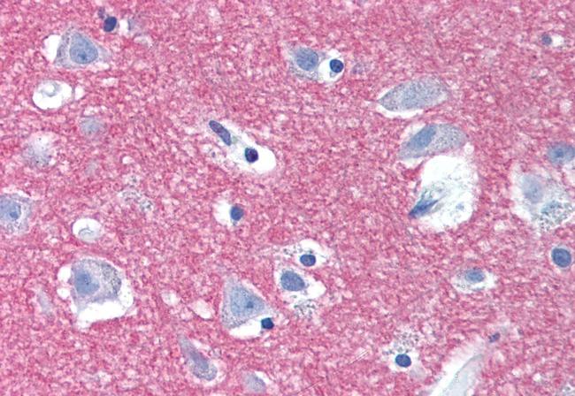 Syntaxin 1 Antibody in Immunohistochemistry (Paraffin) (IHC (P))