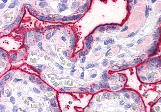 SURF4 Antibody in Immunohistochemistry (Paraffin) (IHC (P))