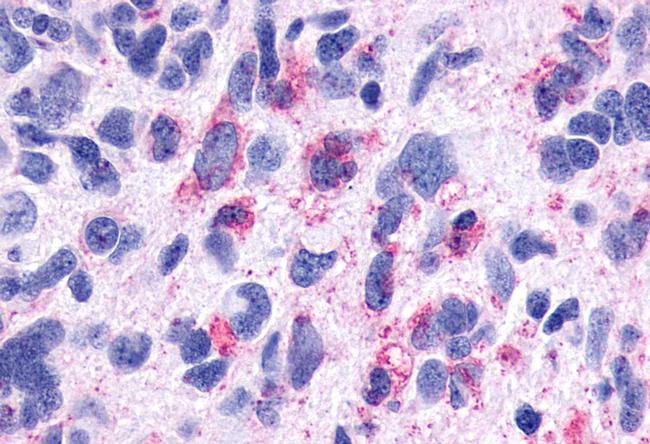 TACR3 Antibody in Immunohistochemistry (Paraffin) (IHC (P))