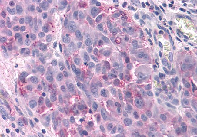 TAS1R3 Antibody in Immunohistochemistry (Paraffin) (IHC (P))