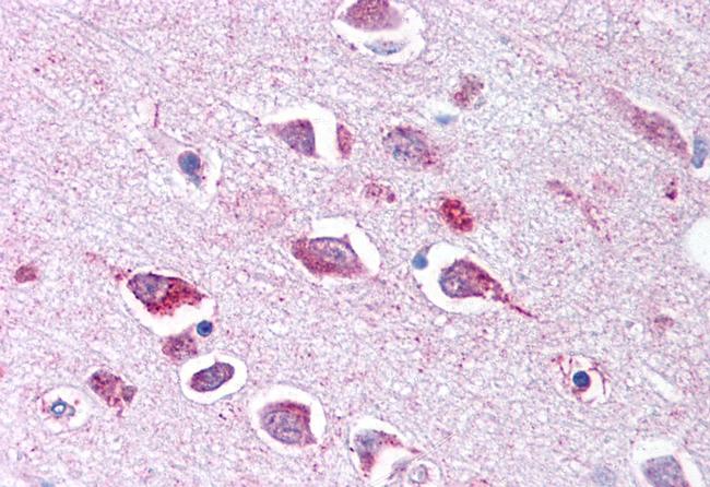 TLL2 Antibody in Immunohistochemistry (Paraffin) (IHC (P))