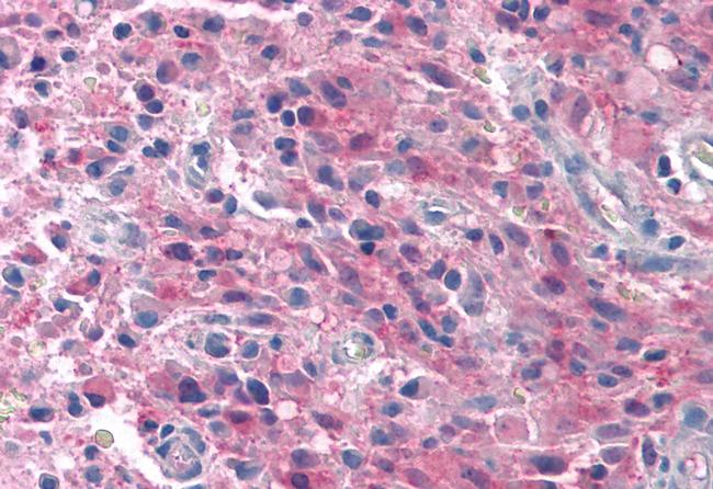 TRPM4 Antibody in Immunohistochemistry (Paraffin) (IHC (P))