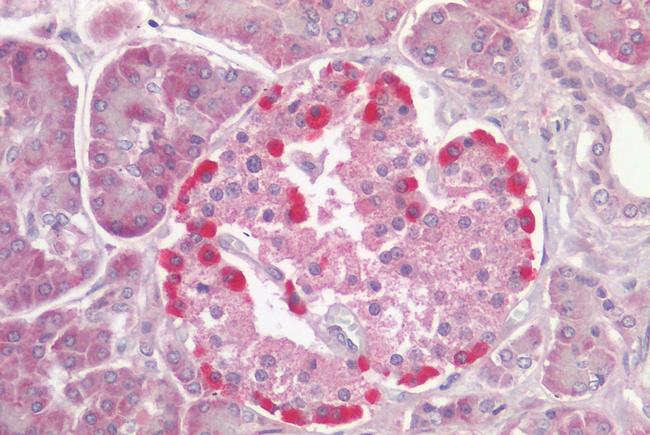 TRPV4 Antibody in Immunohistochemistry (Paraffin) (IHC (P))