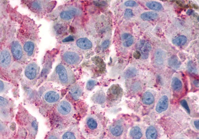 VIPR1 Antibody in Immunohistochemistry (Paraffin) (IHC (P))