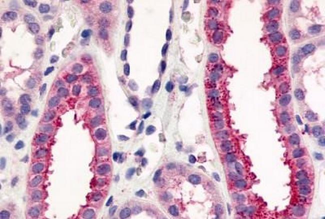 VN1R1 Antibody in Immunohistochemistry (Paraffin) (IHC (P))