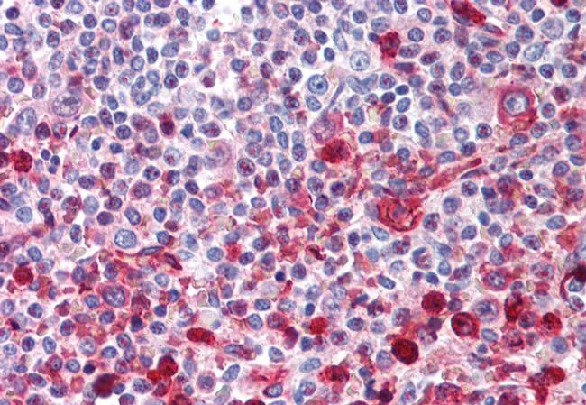 WNT16 Antibody in Immunohistochemistry (Paraffin) (IHC (P))