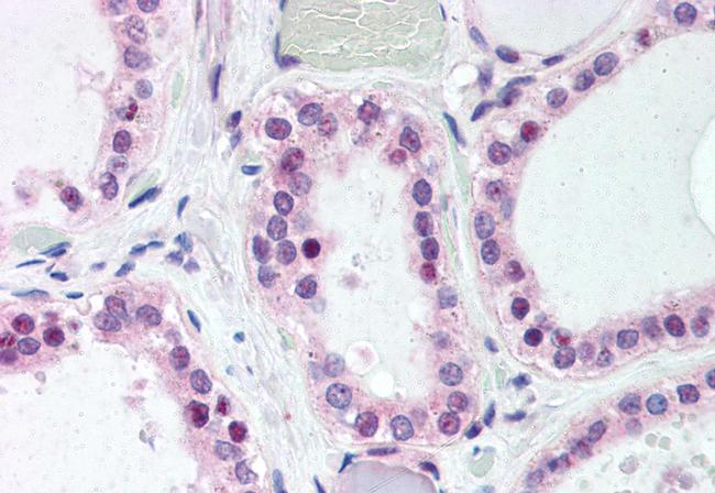 WNT4 Antibody in Immunohistochemistry (Paraffin) (IHC (P))