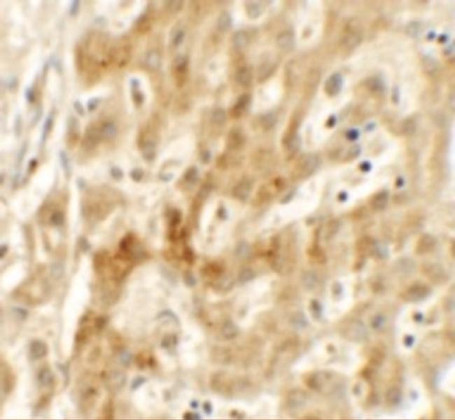 TMEM106B Antibody in Immunohistochemistry (IHC)