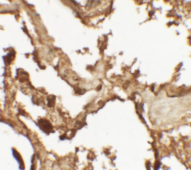 VKORC1 Antibody in Immunohistochemistry (IHC)