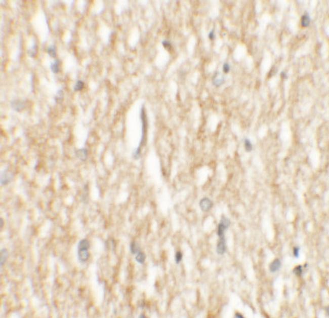 PHOX2A Antibody in Immunohistochemistry (IHC)