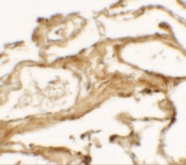 NBS1 Antibody in Immunohistochemistry (IHC)