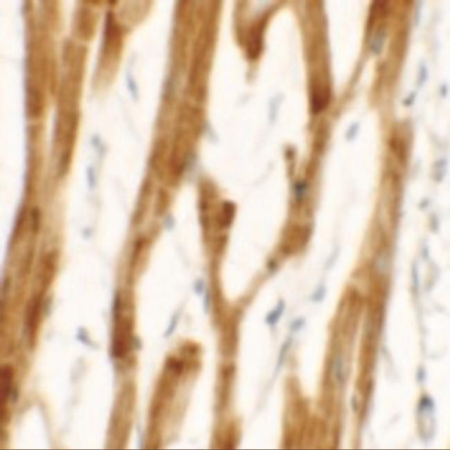 FCHO2 Antibody in Immunohistochemistry (IHC)