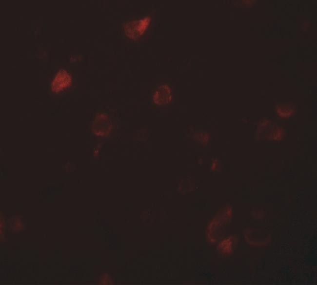 CCDC22 Antibody in Immunohistochemistry (IHC)