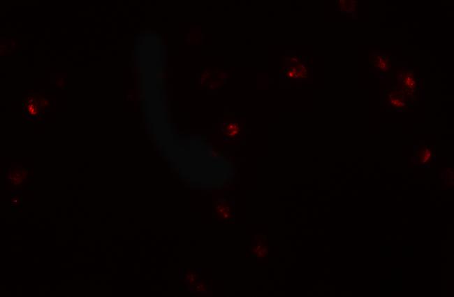 CRIM1 Antibody in Immunocytochemistry (ICC/IF)