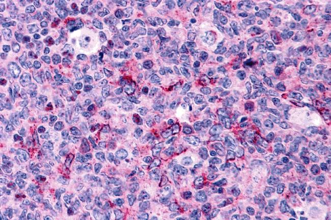 Caspase 3 Antibody in Immunohistochemistry (IHC)