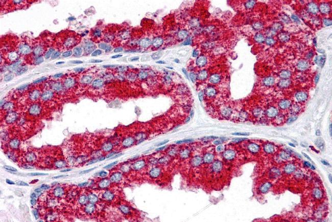 EMX2 Antibody in Immunohistochemistry (IHC)