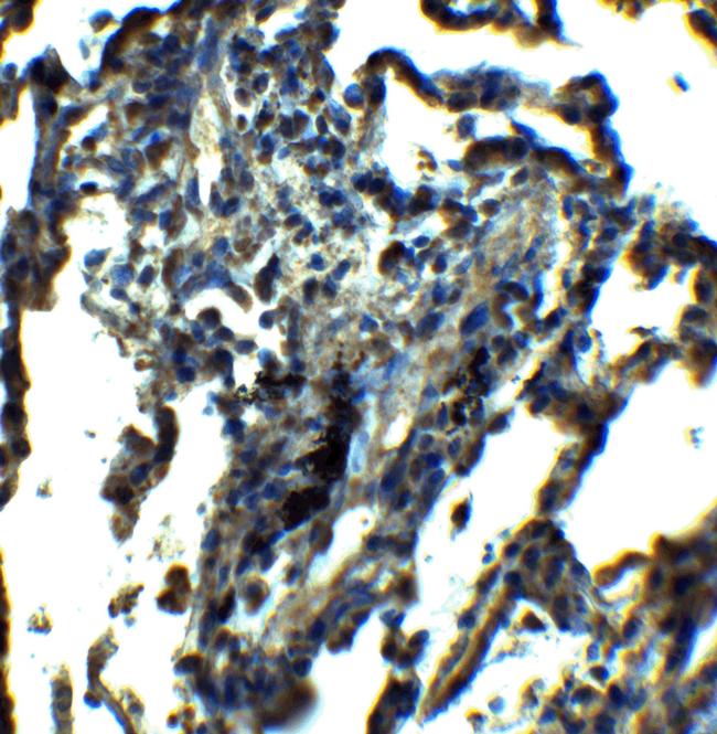 NDFIP1 Antibody in Immunohistochemistry (IHC)