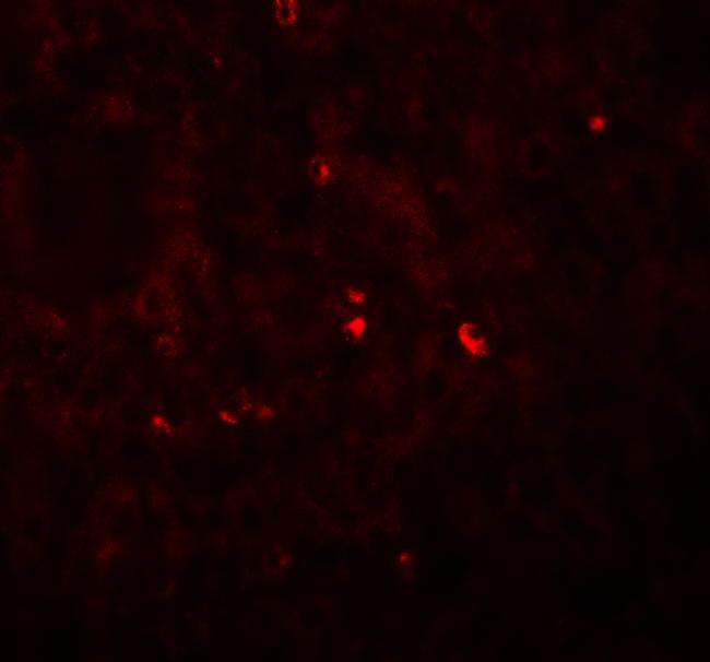 Angiogenin Antibody in Immunohistochemistry (IHC)