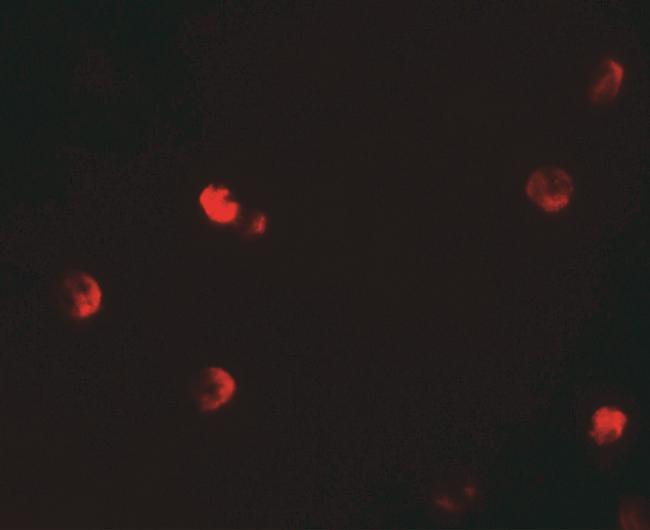 p57 Kip2 Antibody in Immunocytochemistry (ICC/IF)