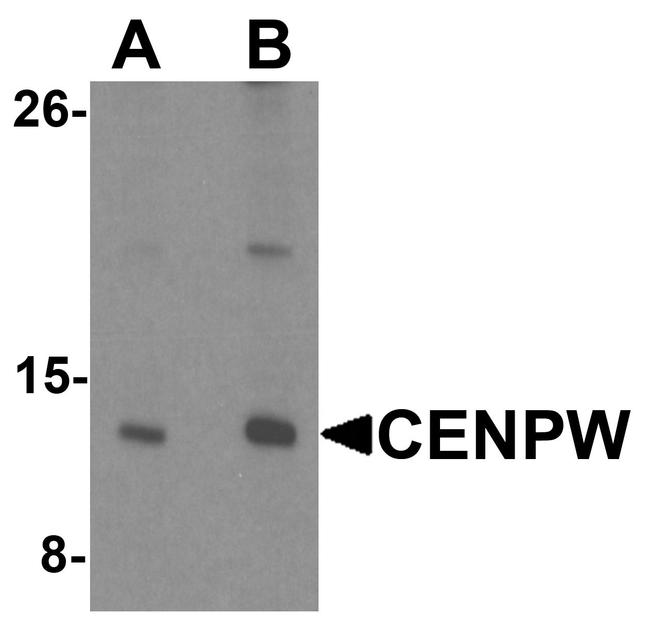 CENPW Antibody in Western Blot (WB)