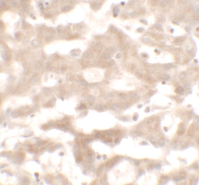 VNN3 Antibody in Immunohistochemistry (IHC)