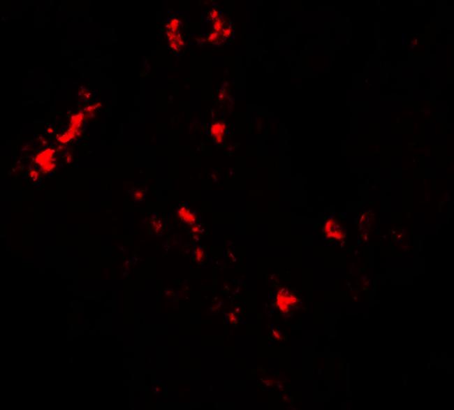 CMPK2 Antibody in Immunohistochemistry (IHC)