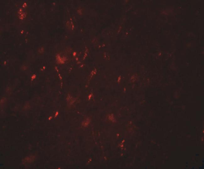 POU3F2 Antibody in Immunohistochemistry (IHC)