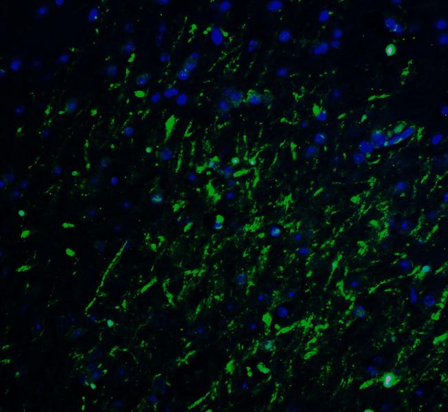 LMX1A Antibody in Immunohistochemistry (IHC)