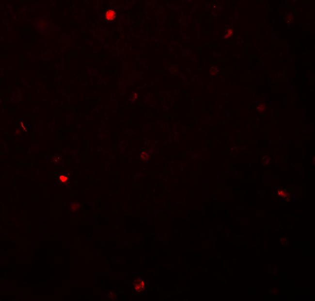 FOXH1 Antibody in Immunohistochemistry (IHC)