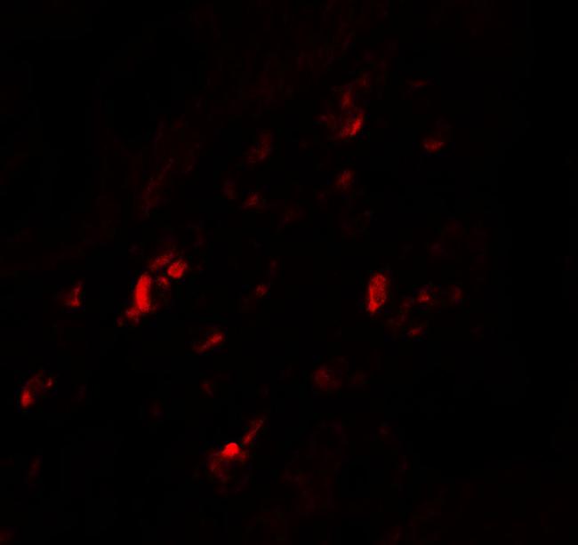 CRTH2 Antibody in Immunohistochemistry (IHC)