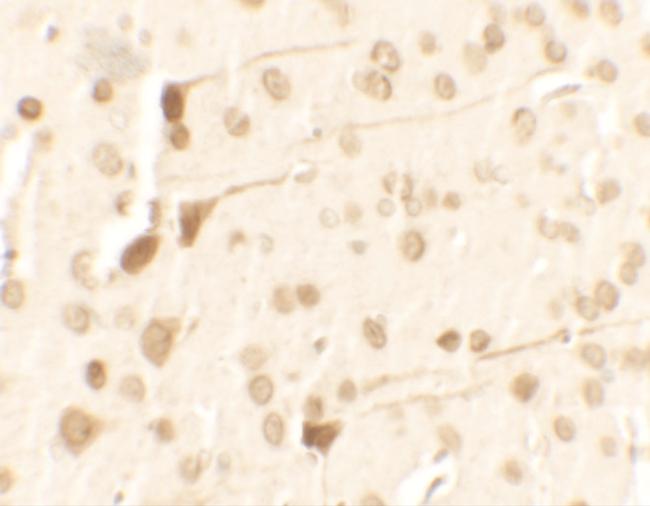 TPT1 Antibody in Immunohistochemistry (IHC)