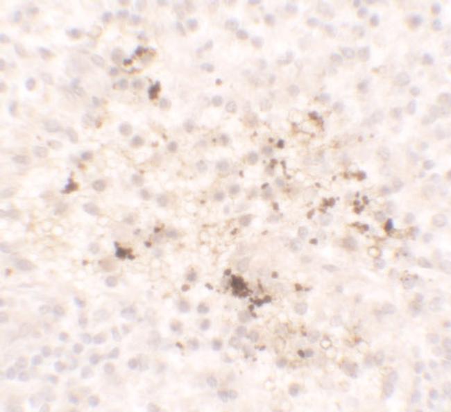 MCP-1 Antibody in Immunohistochemistry (IHC)