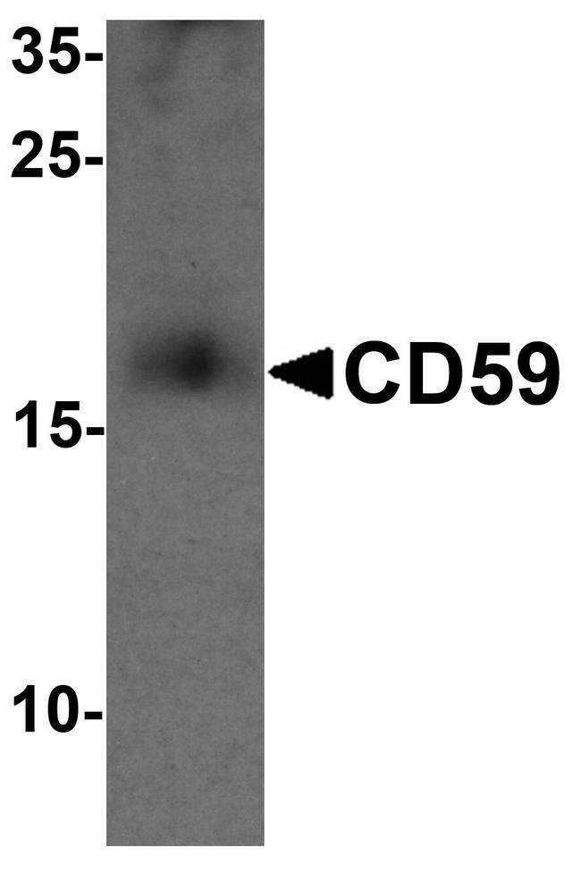 CD59 Antibody in Western Blot (WB)