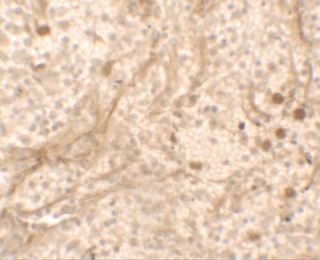 PIBF1 Antibody in Immunohistochemistry (IHC)